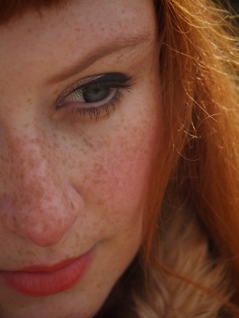 taeden freckles redhead
